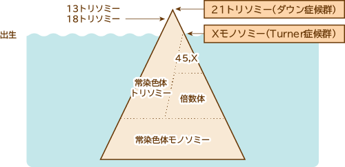 出生前の染色体異常