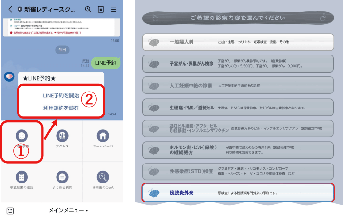 予約について（WEB・LINE予約）