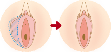 左右の形が違う