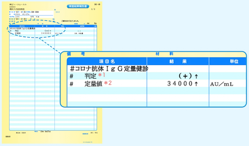 抗体検査の見方