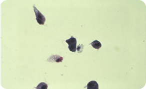 トリコモナス原虫（Trichomonas）